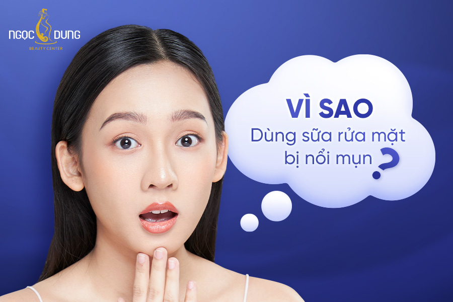 Vì sao dùng sữa rửa mặt bị nổi mụn? Cách xử lý khi bị dị ứng