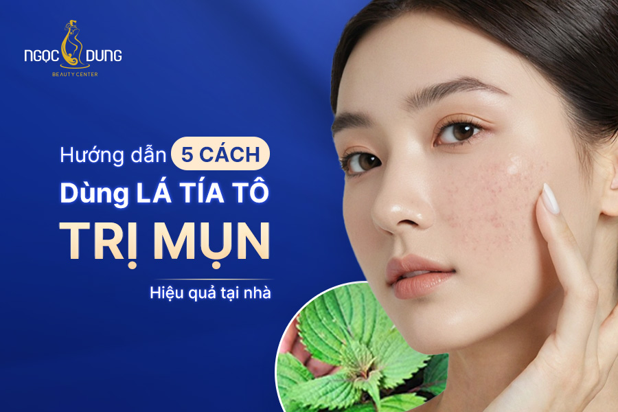 5 cách dùng lá tía tô trị mụn thịt tận gốc, hiệu quả ngay tại nhà