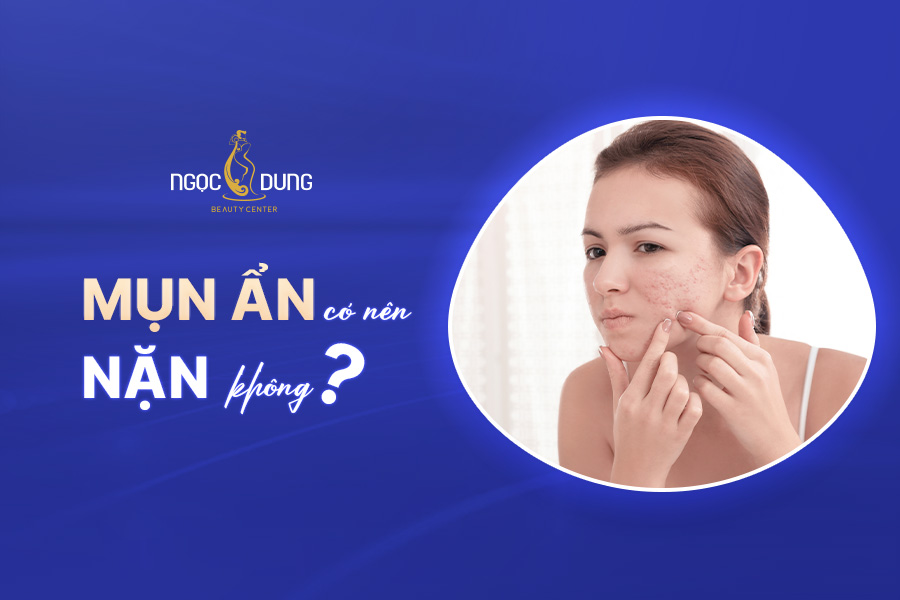 Mụn ẩn có nên nặn không? Nặn mụn sai cách có ảnh hưởng gì?