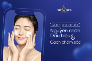 Mụn dị ứng trên da: Nguyên nhân, Dấu hiệu và Cách chăm sóc
