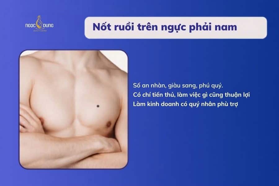 Nốt ruồi ở ngực nói lên điều gì về số mệnh? Tốt hay xấu 15 Nam giới có nốt ruồi ở ngực phải thường có số an nhàn và phú quý