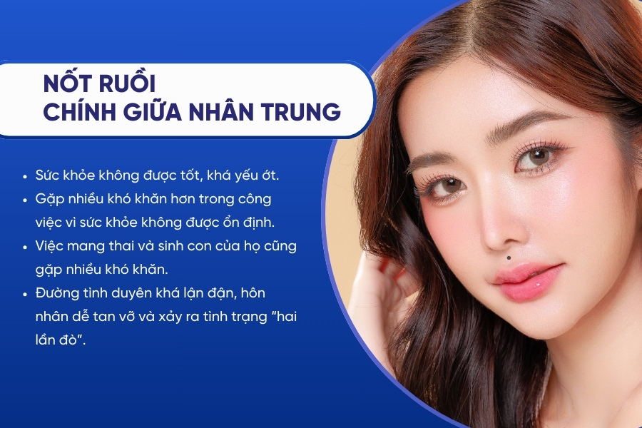 Nốt ruồi mọc ngay chính giữa nhân trung - Sức khỏe không ổn định, khó có con