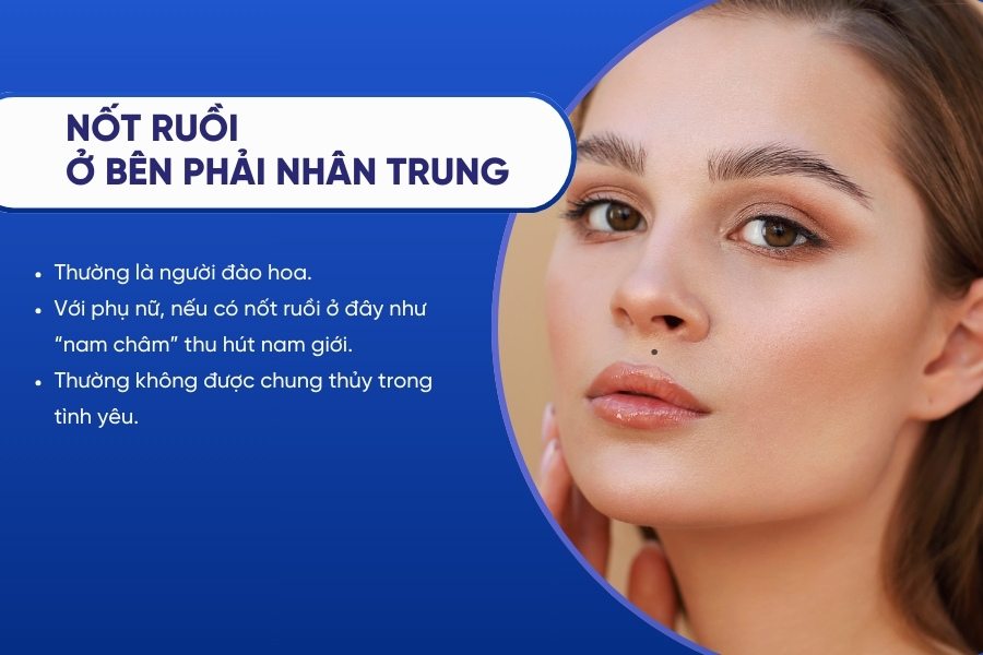 Nốt ruồi mọc ở bên phải nhân trung - Số đào hoa, thu hút người khác giới