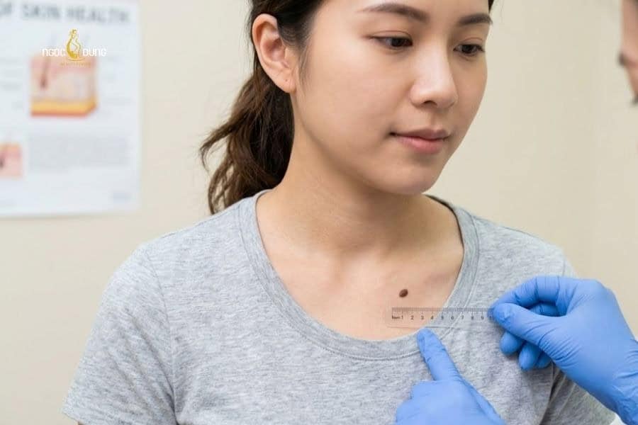 Nốt ruồi ở ngực nói lên điều gì về số mệnh? Tốt hay xấu 10 Nốt ruồi ở vị trí gần ngực là tốt hay xấu thường phụ thuộc vào văn hóa dân gian