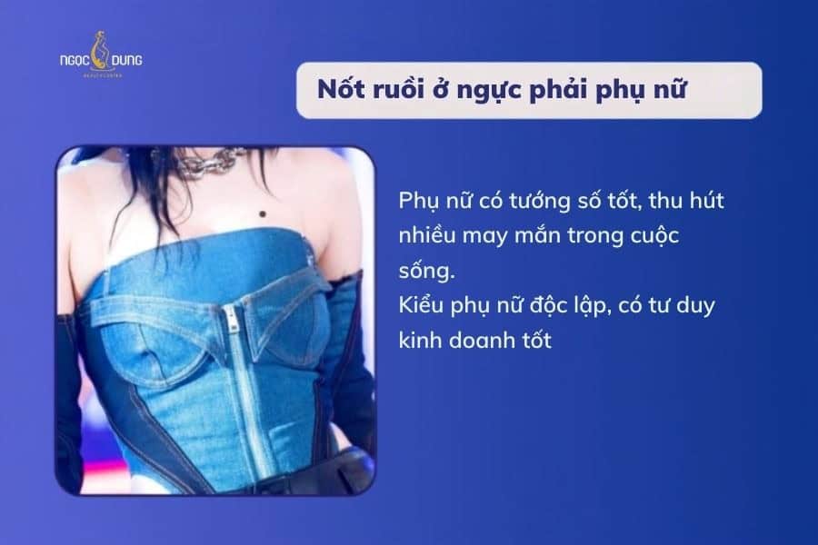 Nốt ruồi ở ngực nói lên điều gì về số mệnh? Tốt hay xấu 12 Phụ nữ có nốt ruồi bên phải thường là người độc lập và quyết đoán