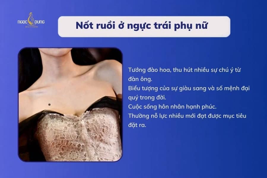 Nốt ruồi ở ngực nói lên điều gì về số mệnh? Tốt hay xấu 11 Phụ nữ có nốt ruồi ở bên trái thường là người giàu tình cảm