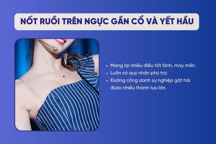 Nốt ruồi trên ngực gần cổ và yết hầu - Có quý nhân phù trợ, đạt nhiều thành tựu lớn