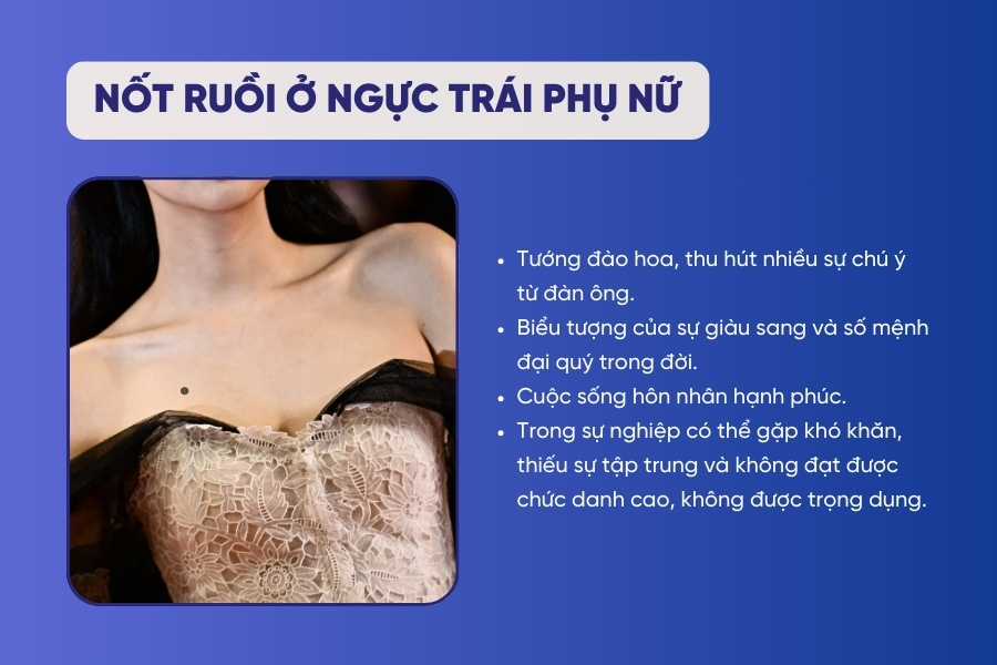 Nốt ruồi ở ngực trái phụ nữ - Tướng đại quý, số đào hoa