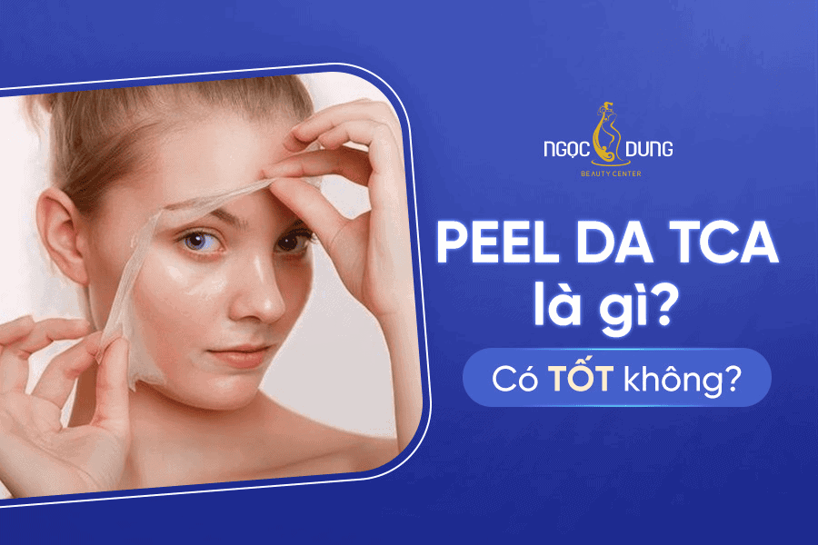 peel da tca la gi