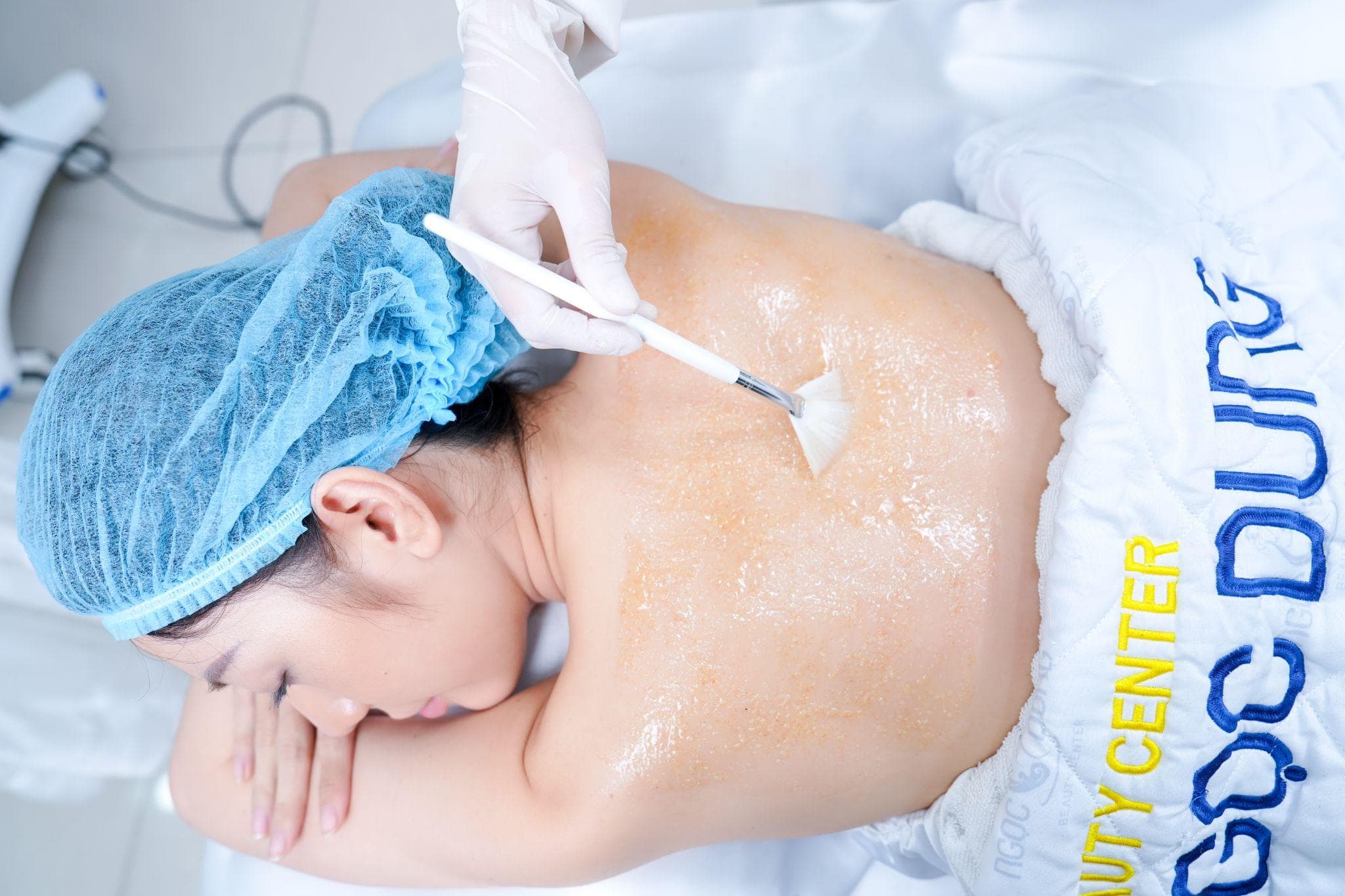 Quy trình peel da TCA chuẩn y khoa với thiết bị hiện đại tại TMV Ngọc Dung
