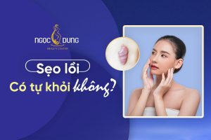 sẹo lồi có tự khỏi không