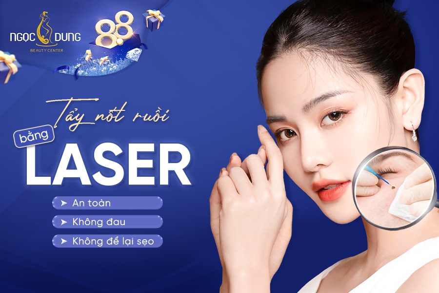 Tẩy nốt ruồi bằng laser: An toàn, không đau, không để lại sẹo