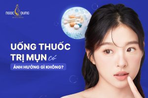 Uống thuốc trị mụn có ảnh hưởng gì không? Có tốt không?
