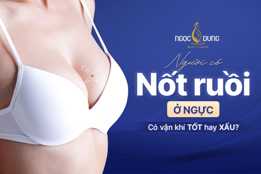 Nốt ruồi ở ngực nói lên điều gì?