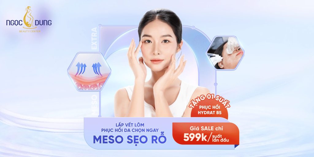 Slider Banner Meso seo ro 599K