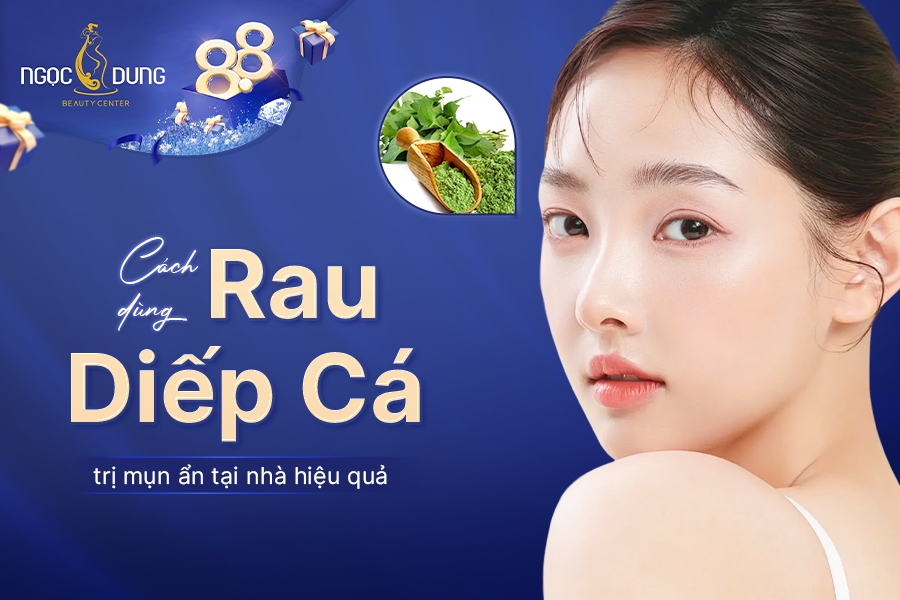 5 cách dùng rau diếp cá trị mụn ẩn hiệu quả ngay tại nhà