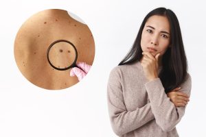 tay not ruoi tai nha