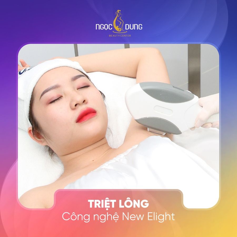 Triệt lông bằng công nghệ New E-Light tại TMV Ngọc Dung Quảng Ninh