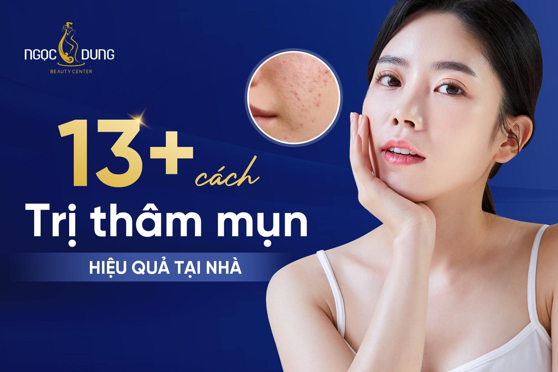 13 cách giảm thâm tại nhà và tại TMV Ngọc Dung 