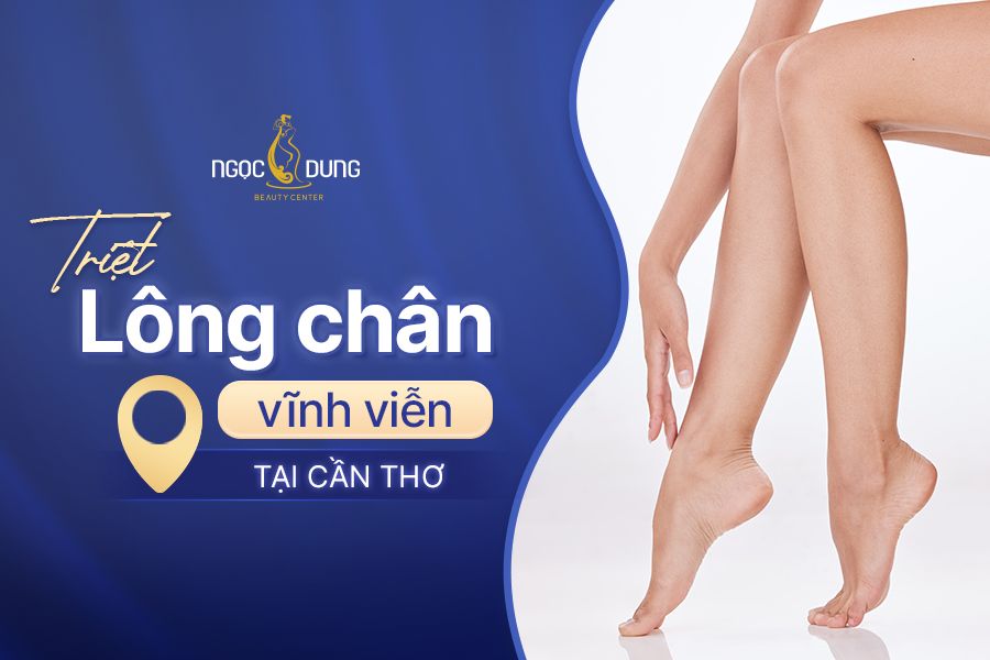 Địa chỉ triệt lông chân vĩnh viễn tại Cần Thơ ở đâu tốt?