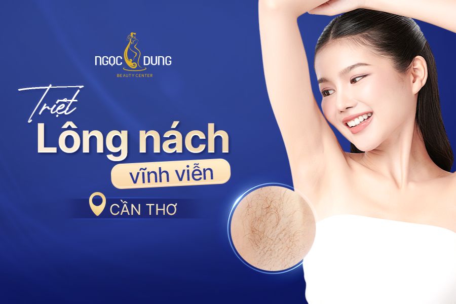 Địa chỉ triệt lông nách vĩnh viễn tại Cần Thơ ở đâu tốt?