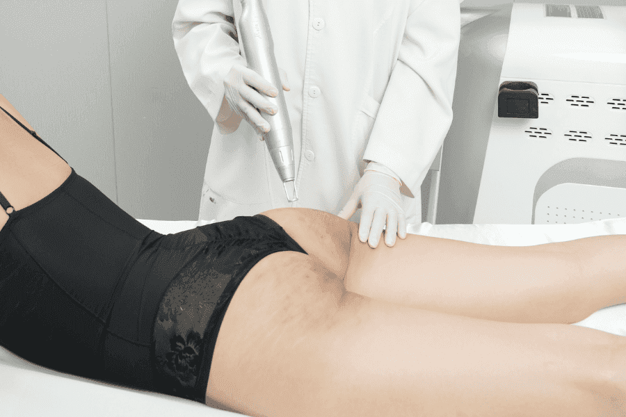 Điều trị thâm mông bằng Laser Picosure Pro