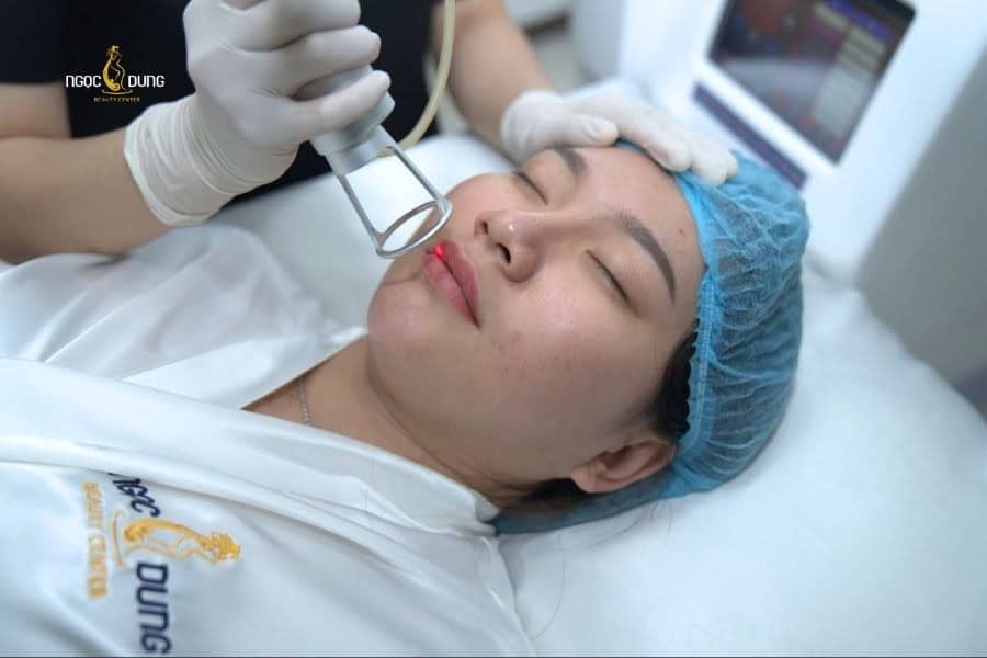 Khử thâm môi với công nghệ cao mang lại kết quả môi đẹp nhanh chóng