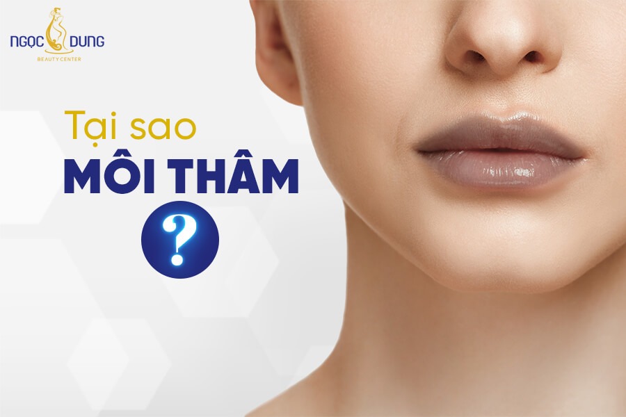 Có nhiều nguyên nhân khiến đôi môi trở nên thâm sạm
