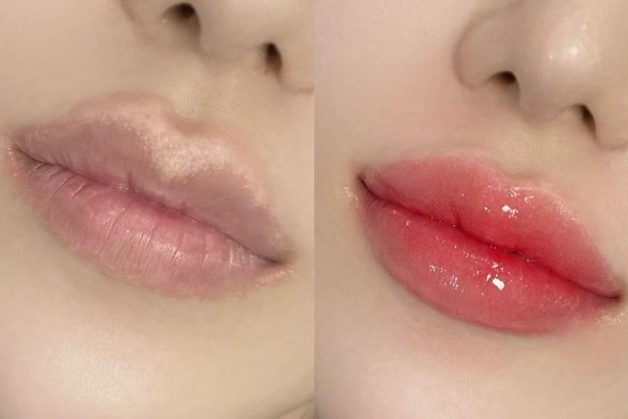 Khử thâm môi giúp đôi môi hồng hào căng mọng