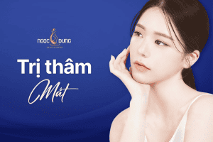 Nên chọn giải pháp trị thâm mắt tại nhà hay laser?