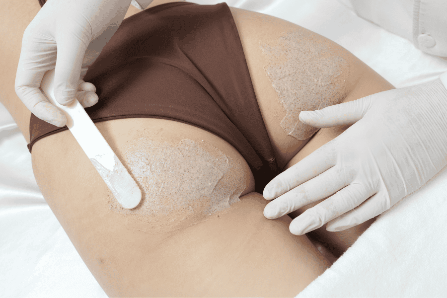 Vệ sinh vùng mông để chuẩn bị cho bước điều trị bằng laser