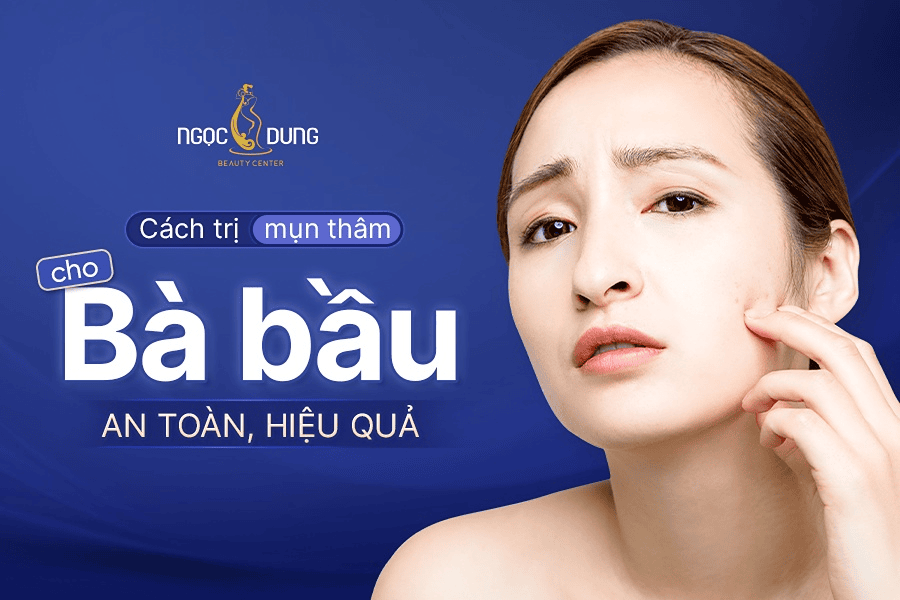 Cách trị mụn thâm cho bà bầu an toàn và hiệu quả nhanh 2 Cách trị mụn thâm cho bà bầu an toàn hiệu quả bằng công nghệ cao