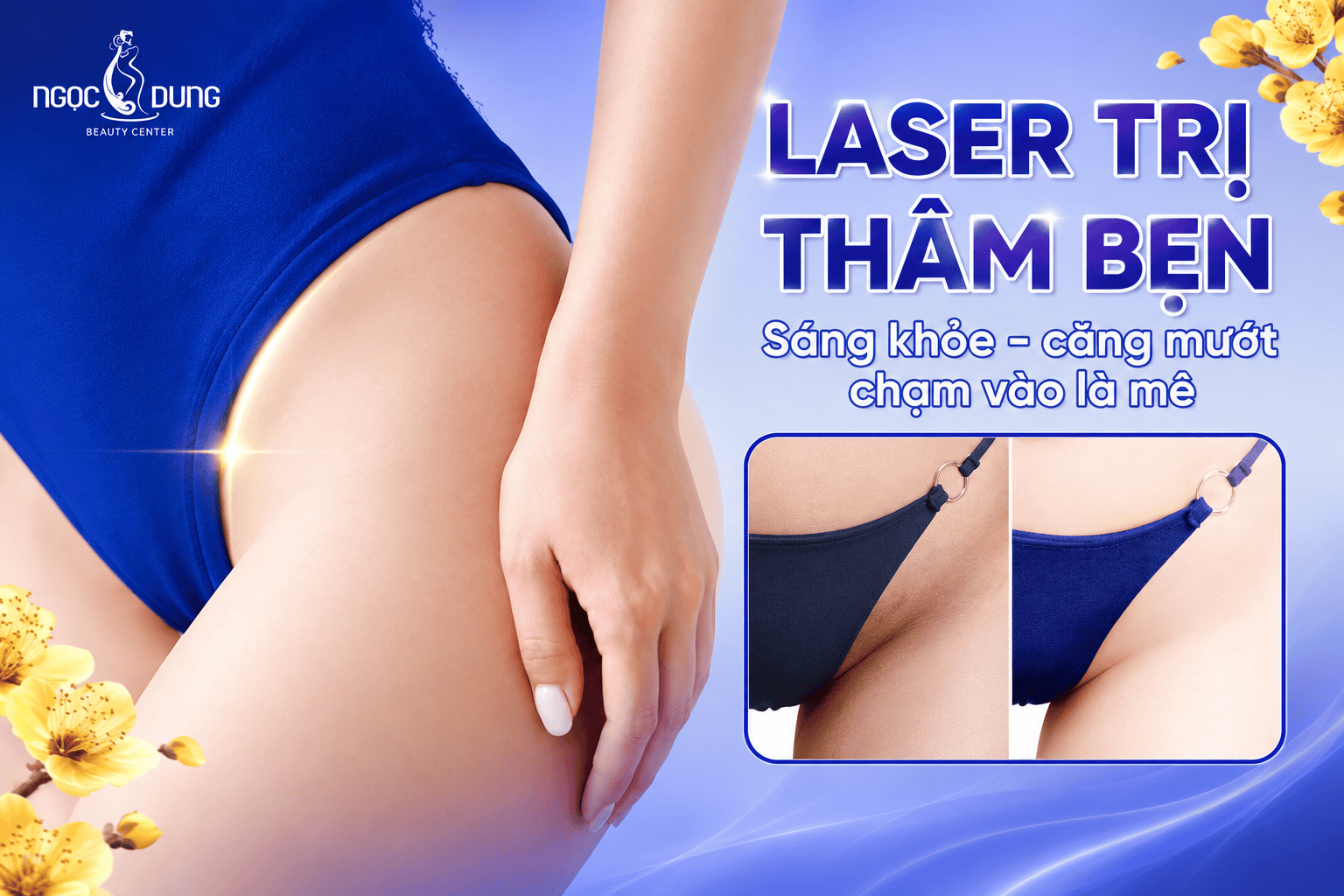 Kết quả thâm bẹn sáng khỏe sau khi trị thâm với Laser tại Ngọc Dung