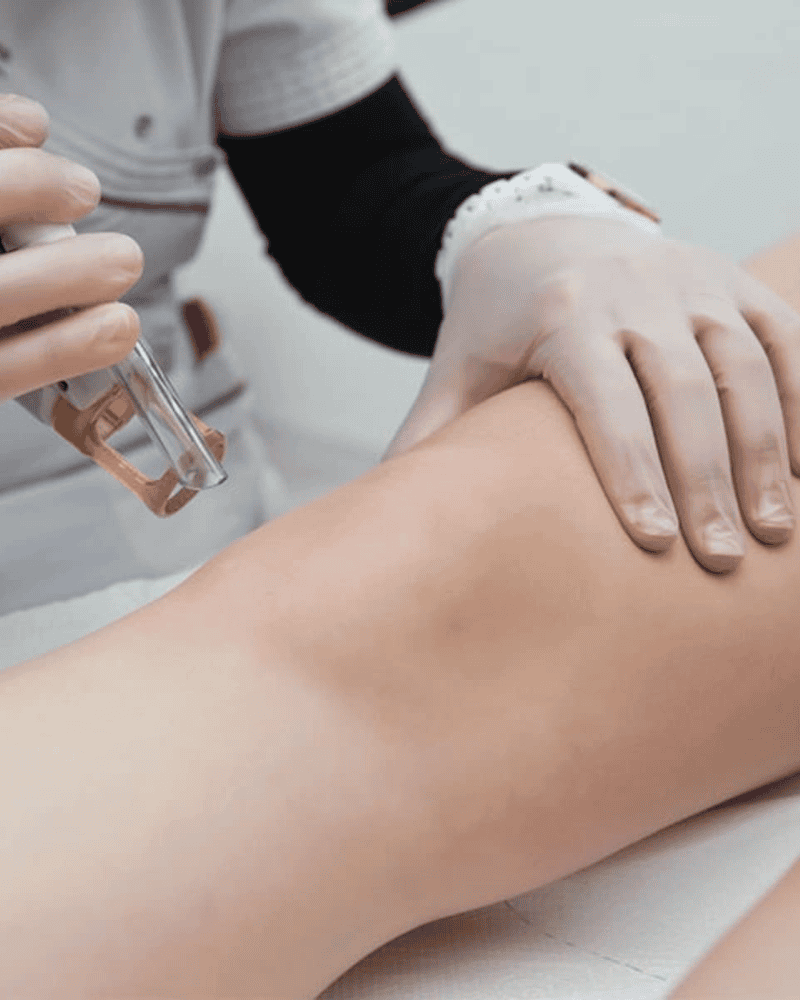 Sử dụng công nghệ hiện đại có thể xử lý triệt để tình trạng thâm đầu gối