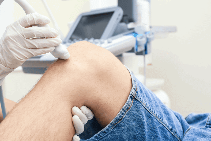 Thâm đầu gối là tình trạng melanin tích tụ quá mức tại lớp thượng bì và hạ bì