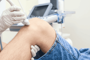 Thâm đầu gối là tình trạng melanin tích tụ quá mức tại lớp thượng bì và hạ bì