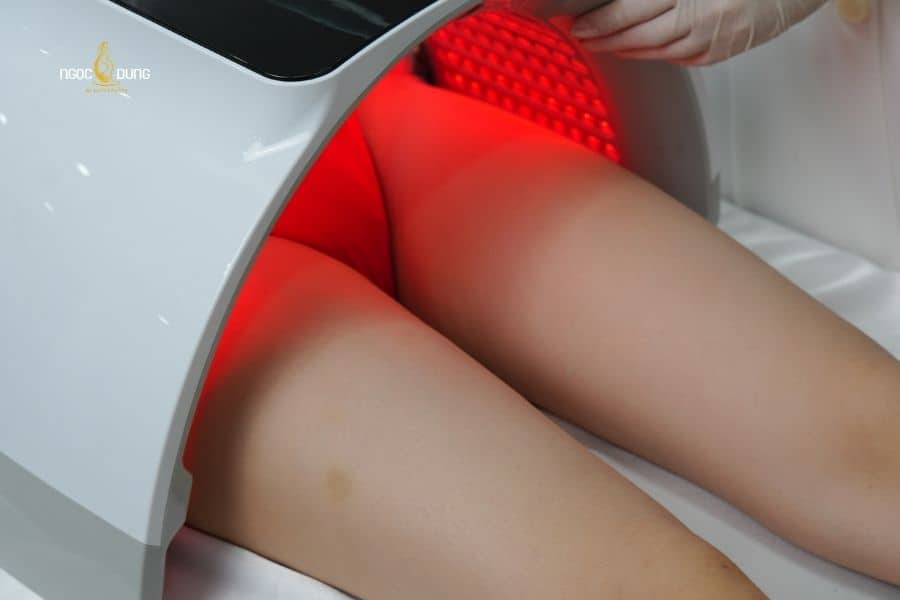 Với tình trạng thâm bẹn rõ và kéo dài, khách hàng nên thăm khám tại thẩm mỹ viện uy tín để được đánh giá và lựa chọn giải pháp phù hợp