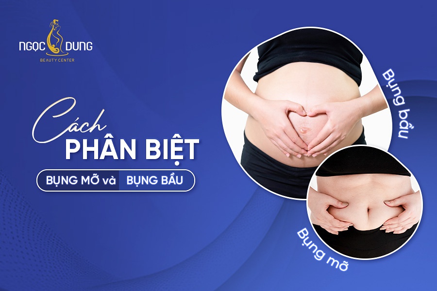 Cách phân biệt bụng bầu và bụng mỡ