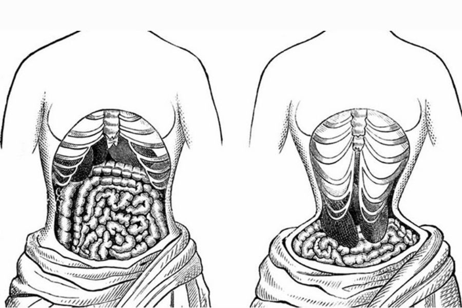 Các cơ quan sẽ bị biến đổi vị trí nếu bạn lạm dụng đai nịt bụng