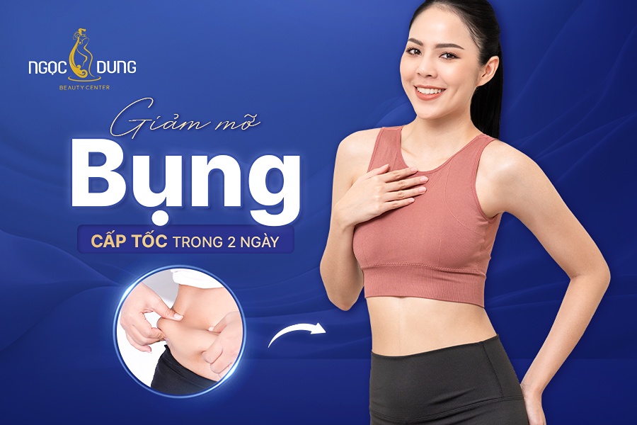 Giảm mỡ bụng cấp tốc trong 2 ngày