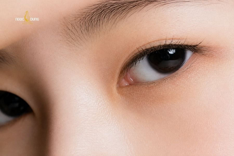 Mắt mí lót là gì? Đẹp hay xấu? Cách khắc phục hiệu quả 11 Người có mắt mí lót thường rất khéo léo trong ứng xử