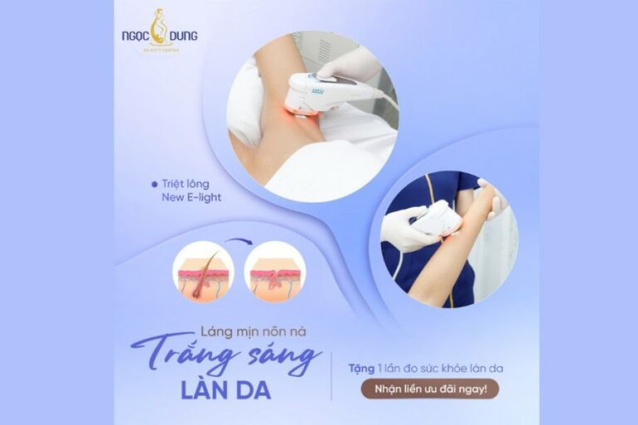 Công nghệ triệt lông nách New E-Light độc quyền tại TMV Ngọc Dung