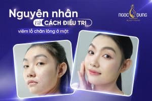 20260304 Pos SEO 831 2