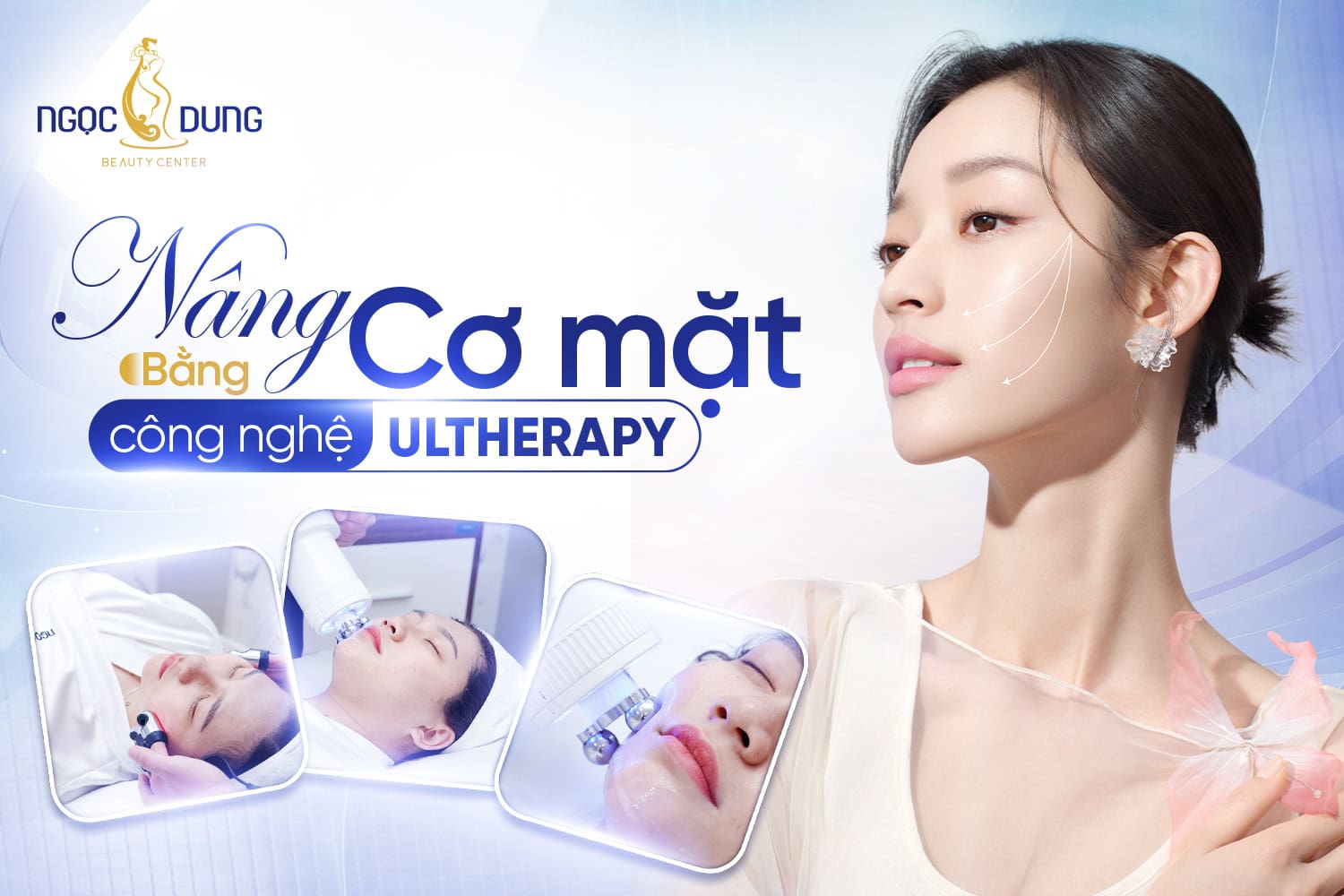 Nâng cơ mặt bằng công nghệ Ultherapy