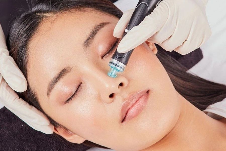 Hydra Facial nhẹ nhàng không xâm lấn, phù hợp mọi loại da