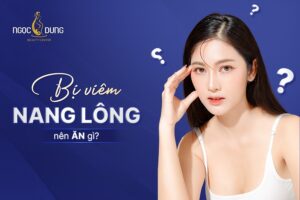 Bị viêm nang lông nên ăn gì?