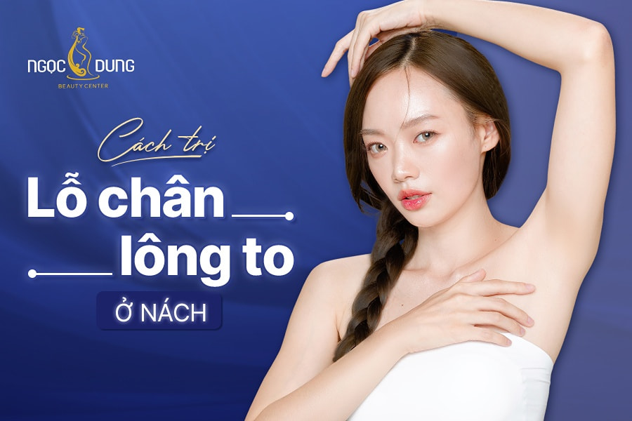 Cách trị lỗ chân lông to ở nách