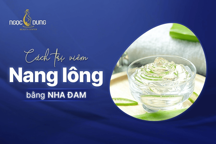 Cách trị viêm nang lông bằng nha đam hiệu quả
