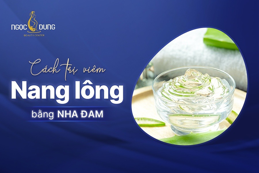 Cách trị viêm nang lông bằng nha đam