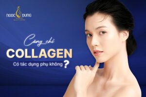 Căng chỉ collagen có tác dụng phụ không?